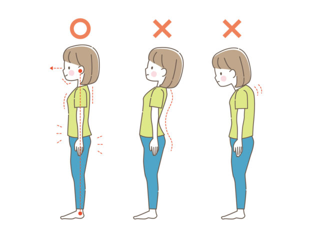 反り腰が治らない原因と反り腰による影響